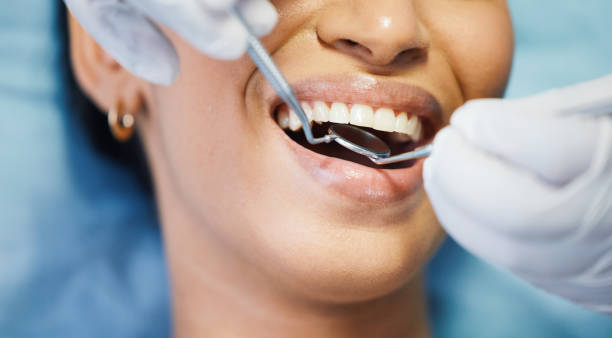 Best Emergency Dental Care for Trauma or Injury in Sunnyside, GA
