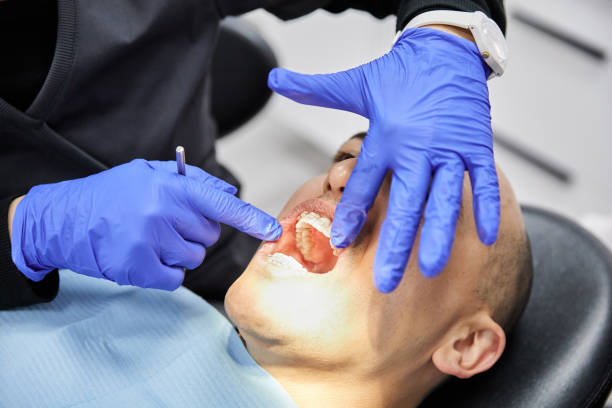 Best Emergency Tooth Extraction in Sunnyside, GA