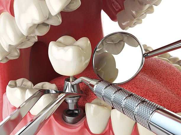 Best Emergency Treatment for Toothache in Sunnyside, GA